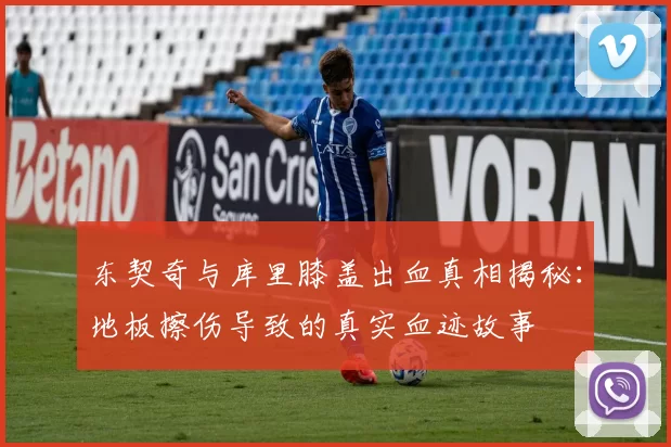 东契奇与库里膝盖出血真相揭秘：地板擦伤导致的真实血迹故事